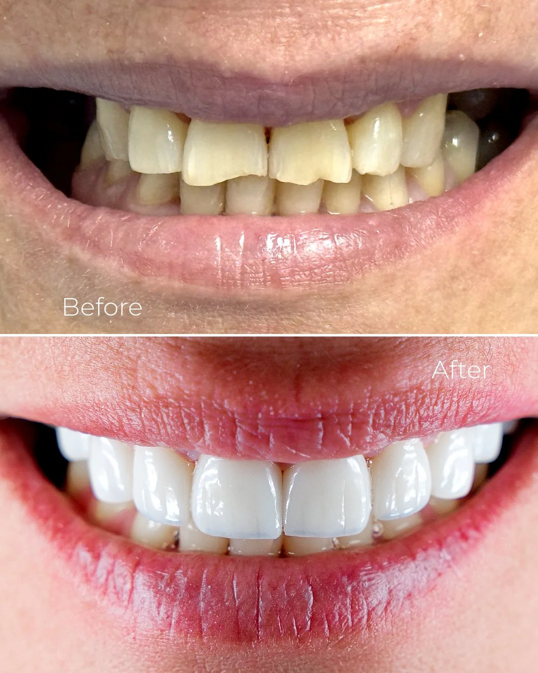 Before and After_2026_5 copy.jpg