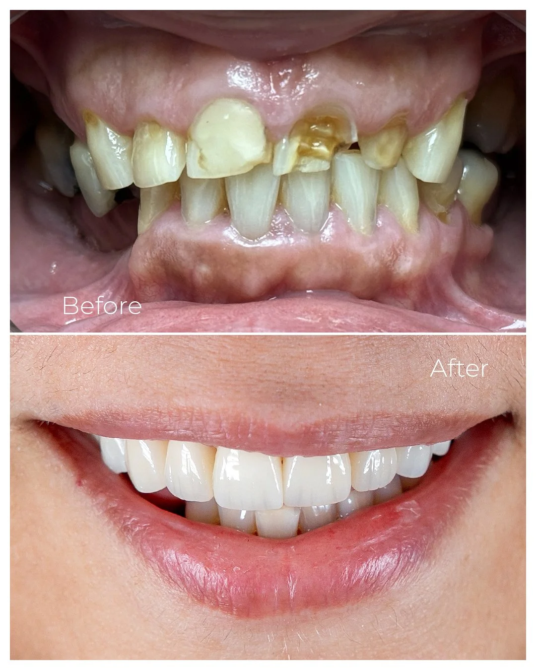 Before and After_06.jpg