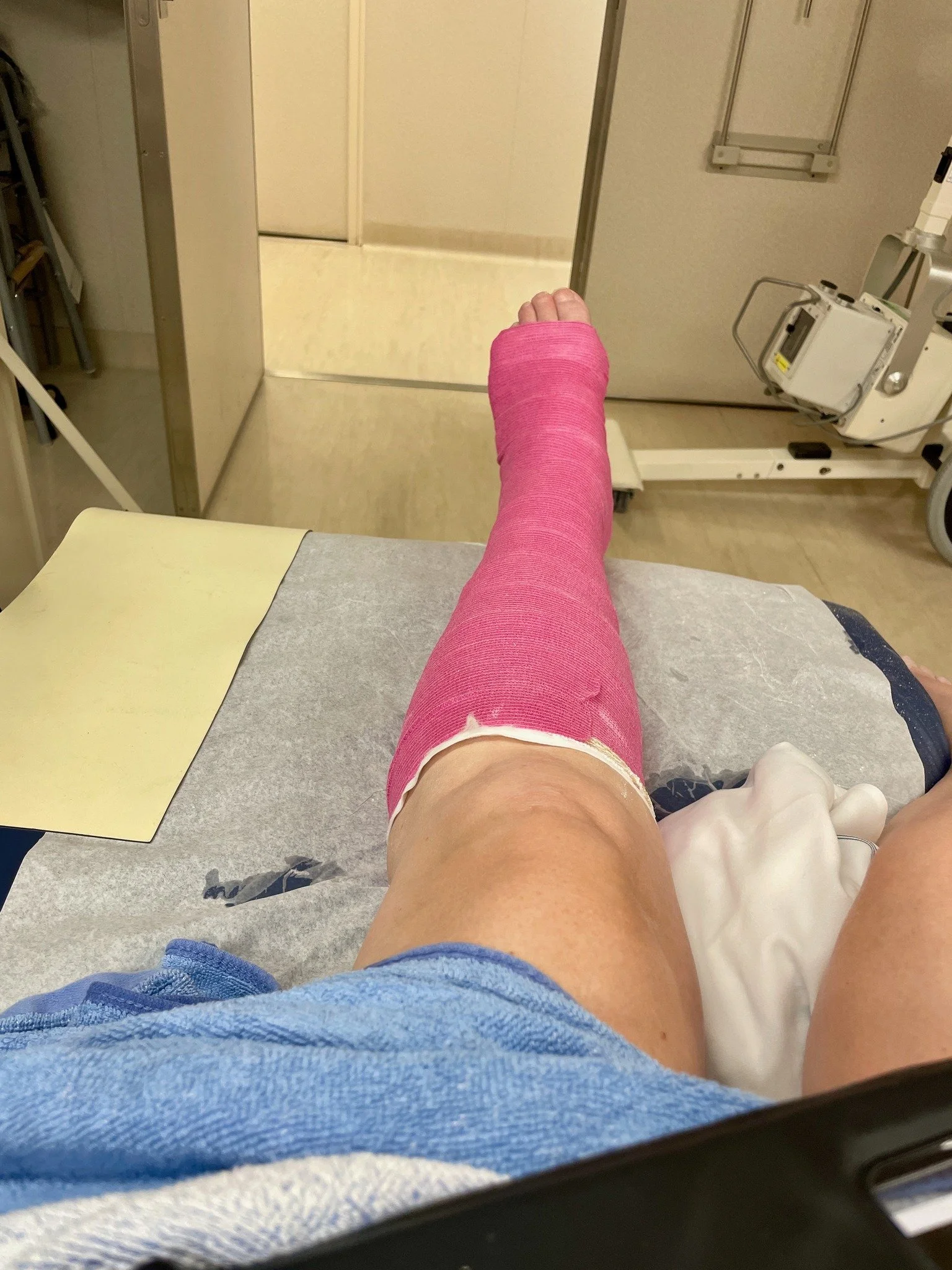 2024-Norwegian Encore-Day 9-Broken Ankle.jpg