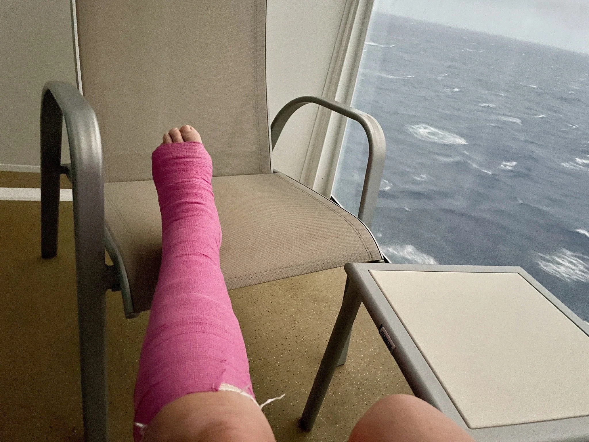 2024-Norwegian Encore-Day 11-Balcony broken ankle.jpg