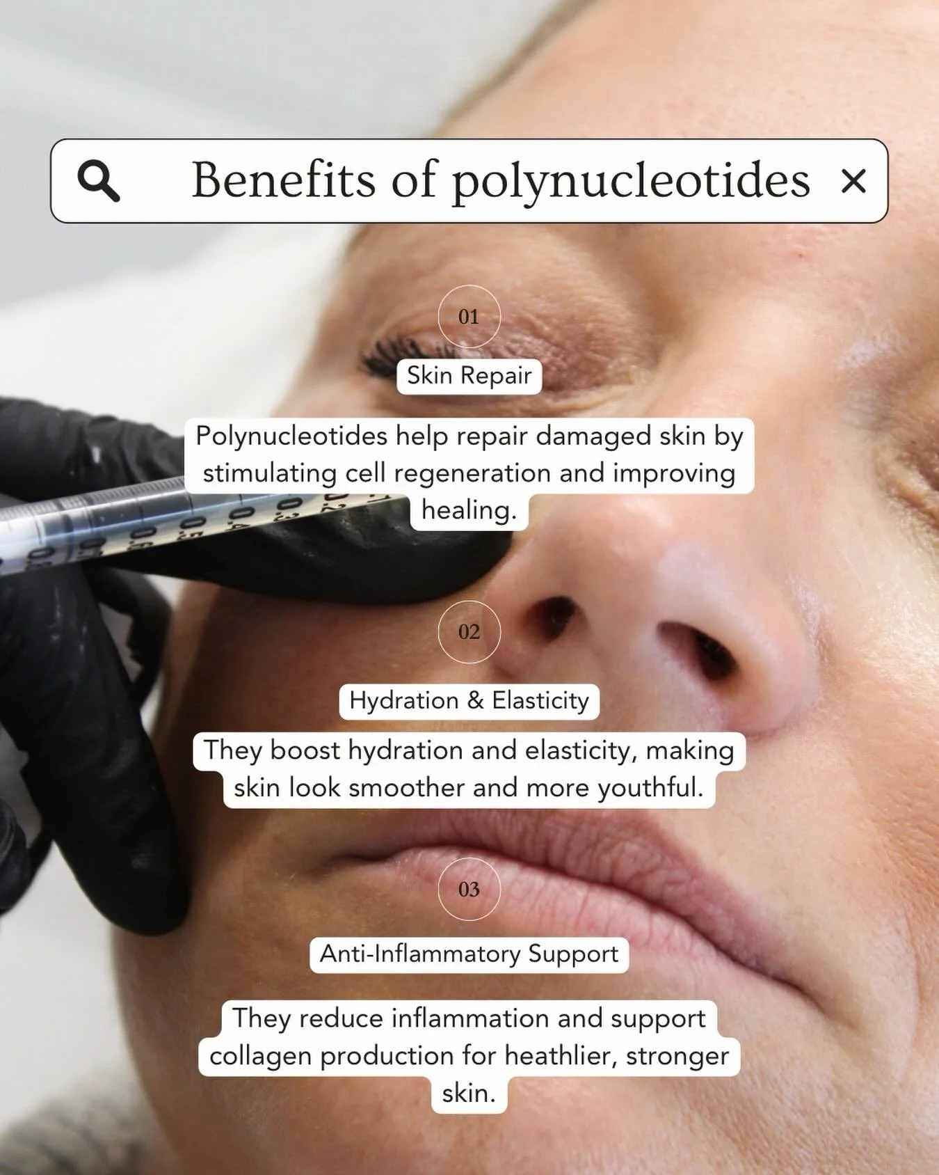 Polynucleotides = skin repair from within ✨

Boost hydration, improve elasticity and support natural collagen for healthier, smoother-looking skin.

Subtle, natural results that just make you look like you!

Ready to start your skin journey? Book you