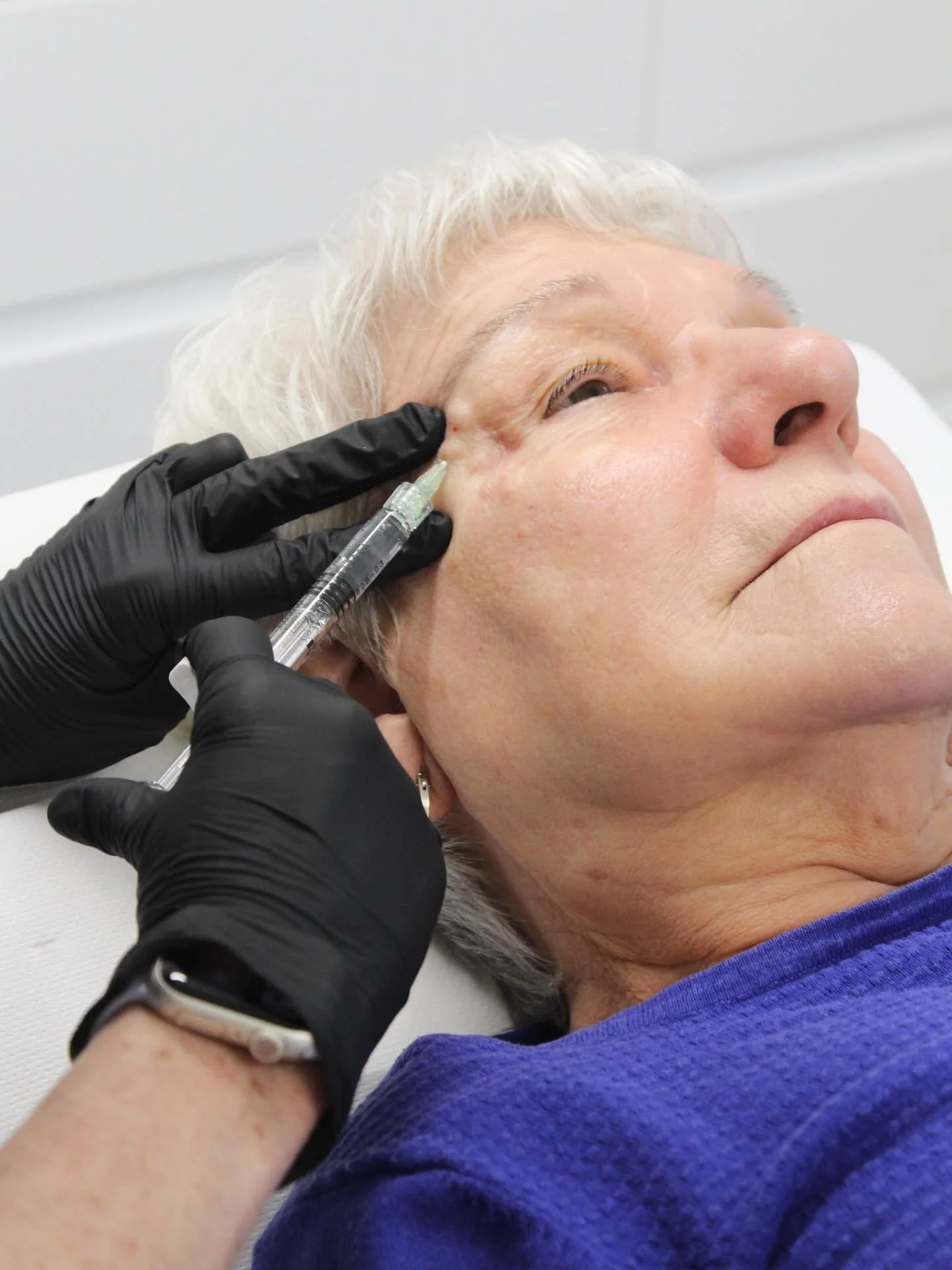 Polynucleotides are one of the most advanced regenerative treatments, working to repair, hydrate and strengthen the skin from within.

The result is smoother texture, improved skin quality and a more radiant, refreshed appearance.

Ready to invest in