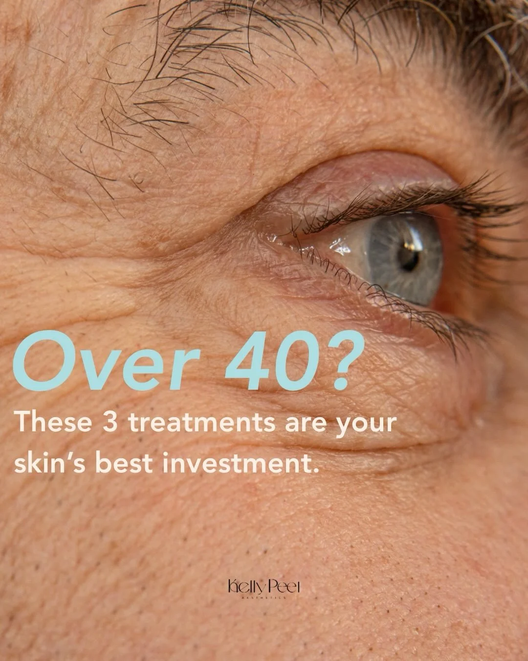 Supporting your skin through every stage ✨

Focused, results-driven treatments designed to restore, strengthen and maintain healthy, radiant skin over time..

Book your appointment in the link in my bio! 
📍 Tilehurst, Reading RG31 5AR

#Polynucleoti