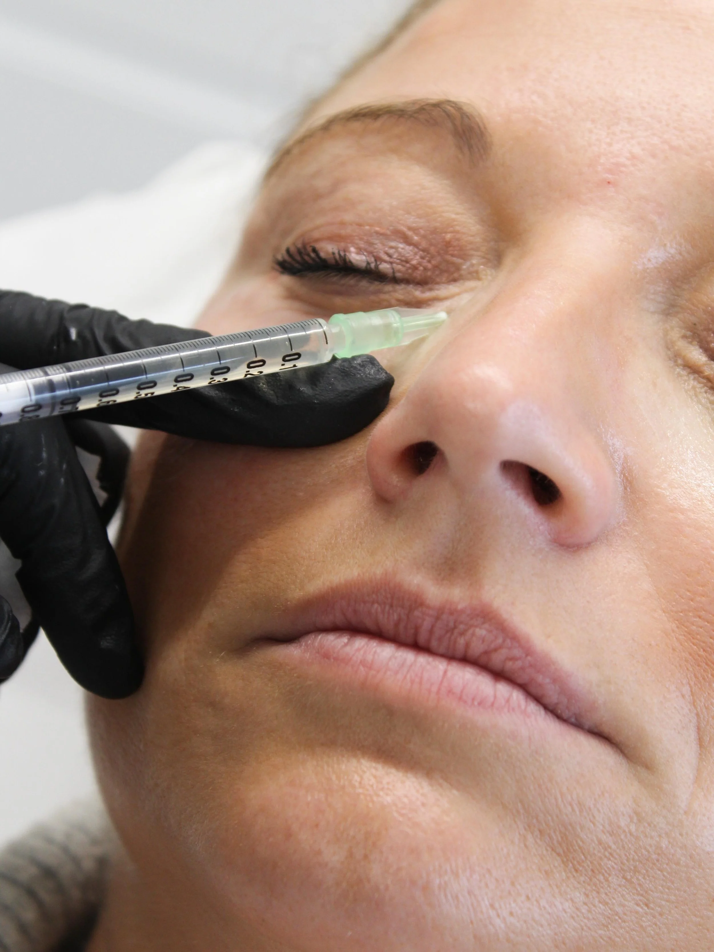 Polynucleotides are one of our favourite treatments for improving skin quality from within ✨

This regenerative treatment works by stimulating cell repair, boosting hydration, improving elasticity and supporting collagen production, helping the skin 