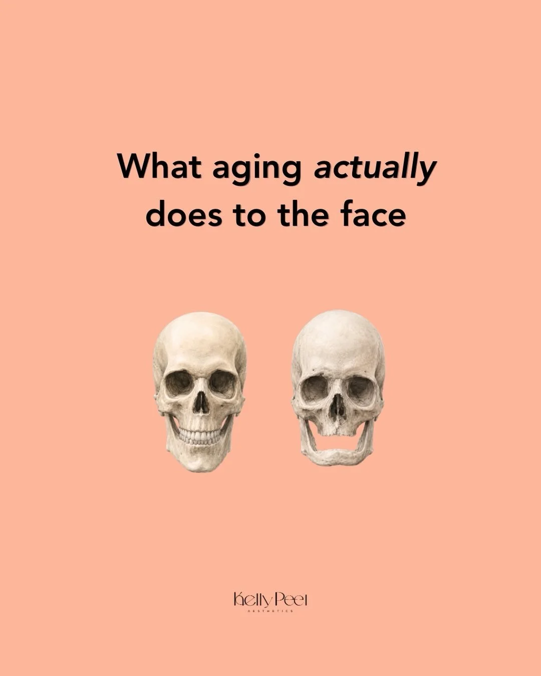 Aging is completely natural, but many people don&rsquo;t realise how much the face changes over time ✨

It&rsquo;s not just about fine lines and wrinkles, collagen loss, reduced skin elasticity, volume changes and muscle movement all play a role in h