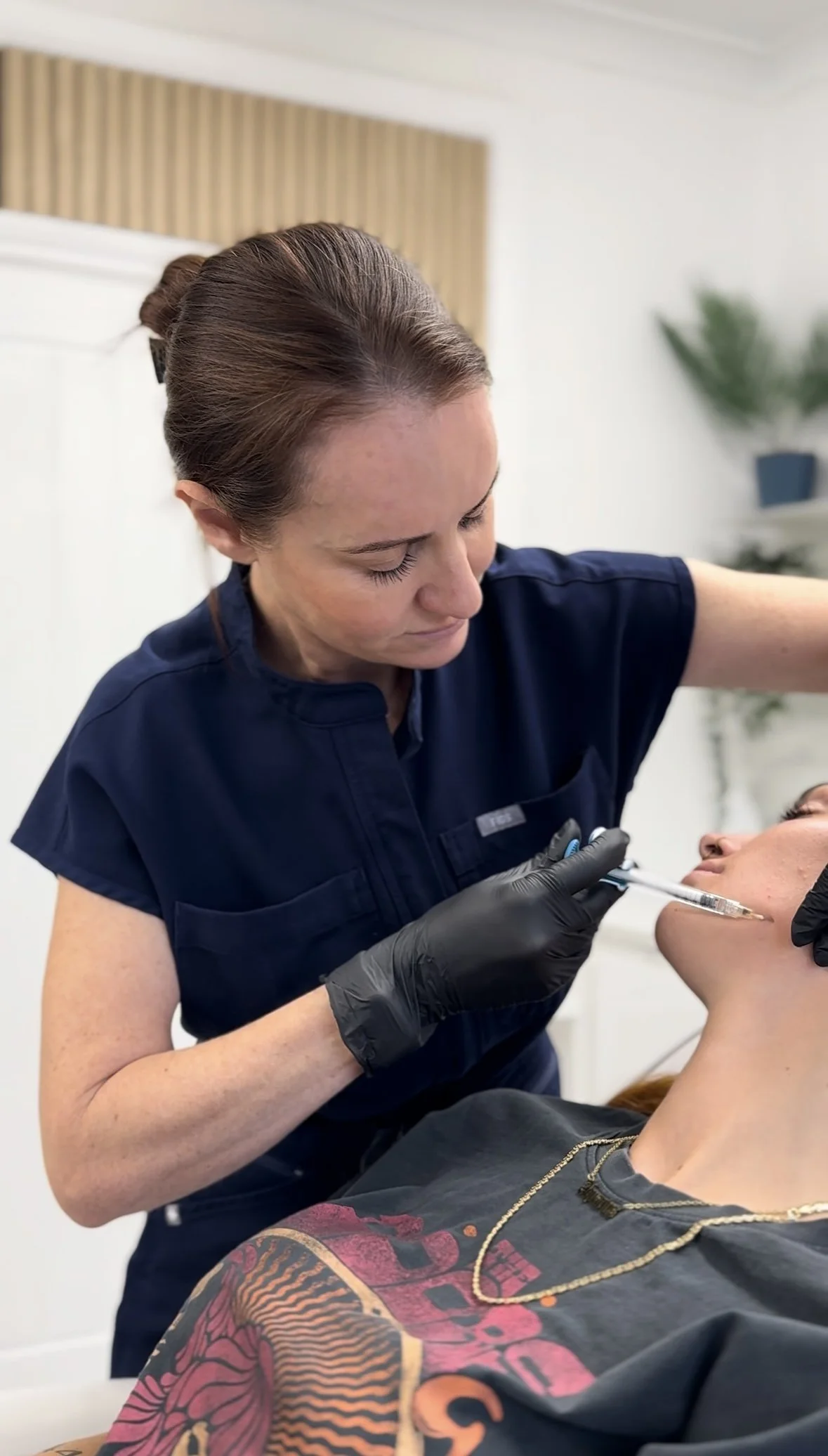 Biostimulator injection applied to lower cheek