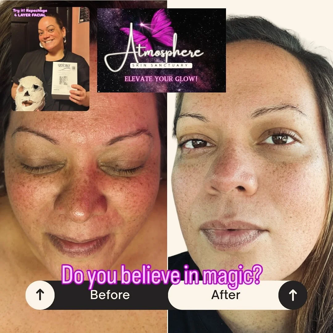 What are you waiting for? Your skin deserves some love. You&rsquo;re worth it!! Book your appointment now.