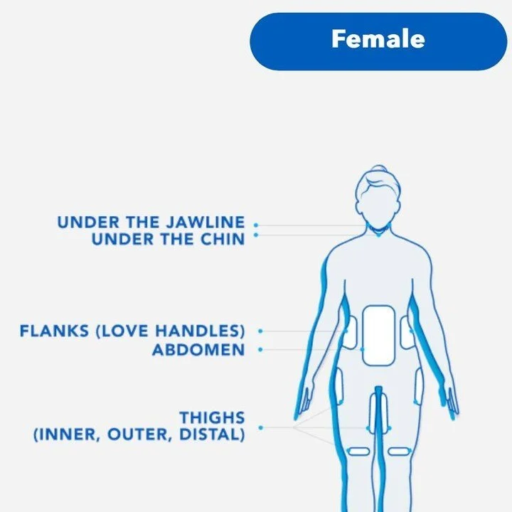 CoolSculpting&reg; is cleared to eliminate stubborn fat under the jawline, under the chin, the upper arms, back fat, bra fat, the flank area (love handles), abdomen, thighs, and under the buttocks (banana roll).

#coolsculpting #freezeyourfat #coolsc