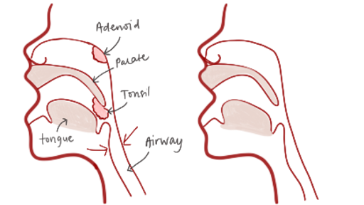 upper airway anatomy.png