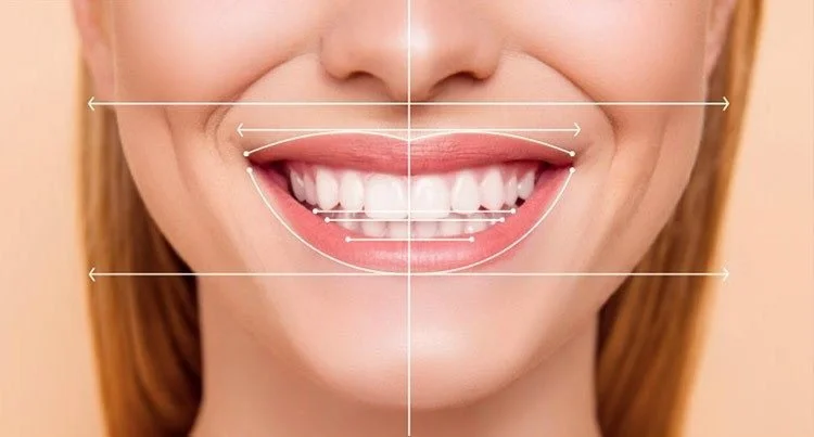 Close-up of a smiling woman's mouth with white teeth, with lines and measurements indicating the proportions of the smile and facial features.