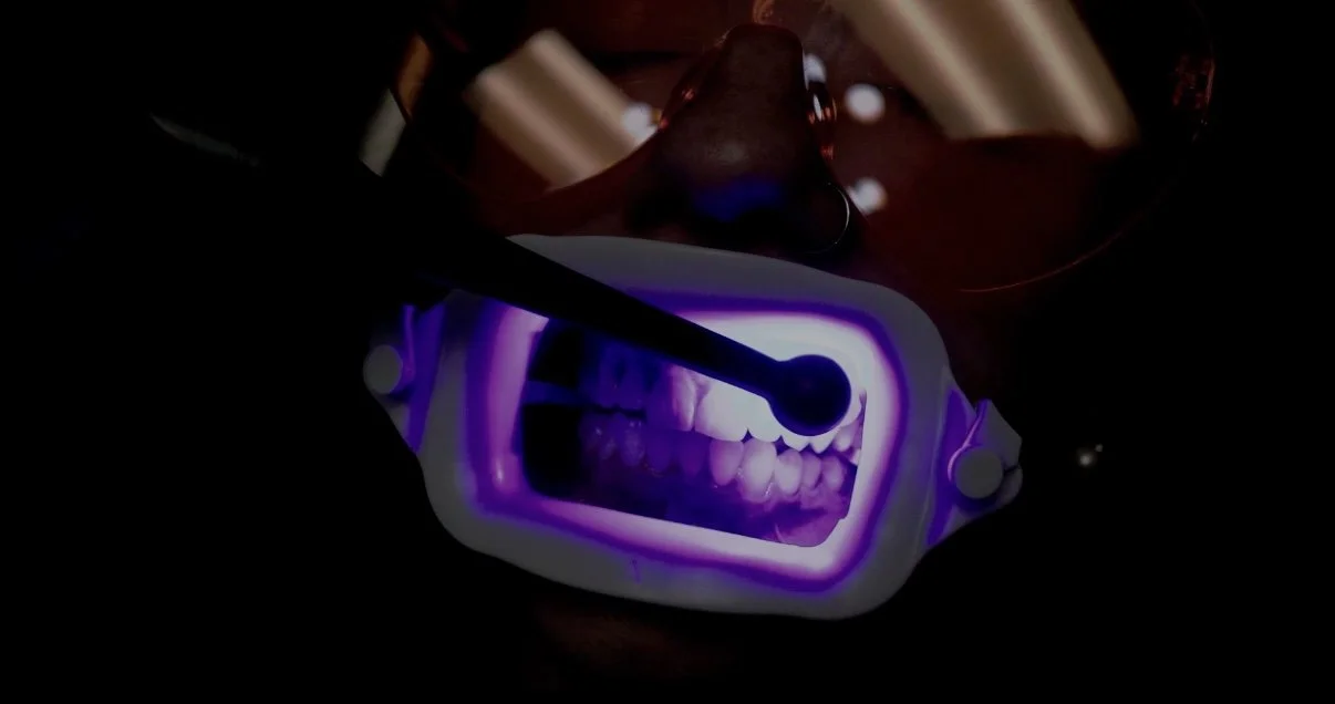 A dental curing light being used to illuminate a patient's teeth inside a dental model or mouth simulator with a purple glow.