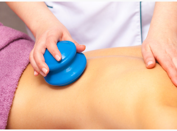 Silicone Myofascial Cupping I