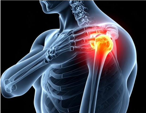 Adhesive Capsulitis Treatment Specialist