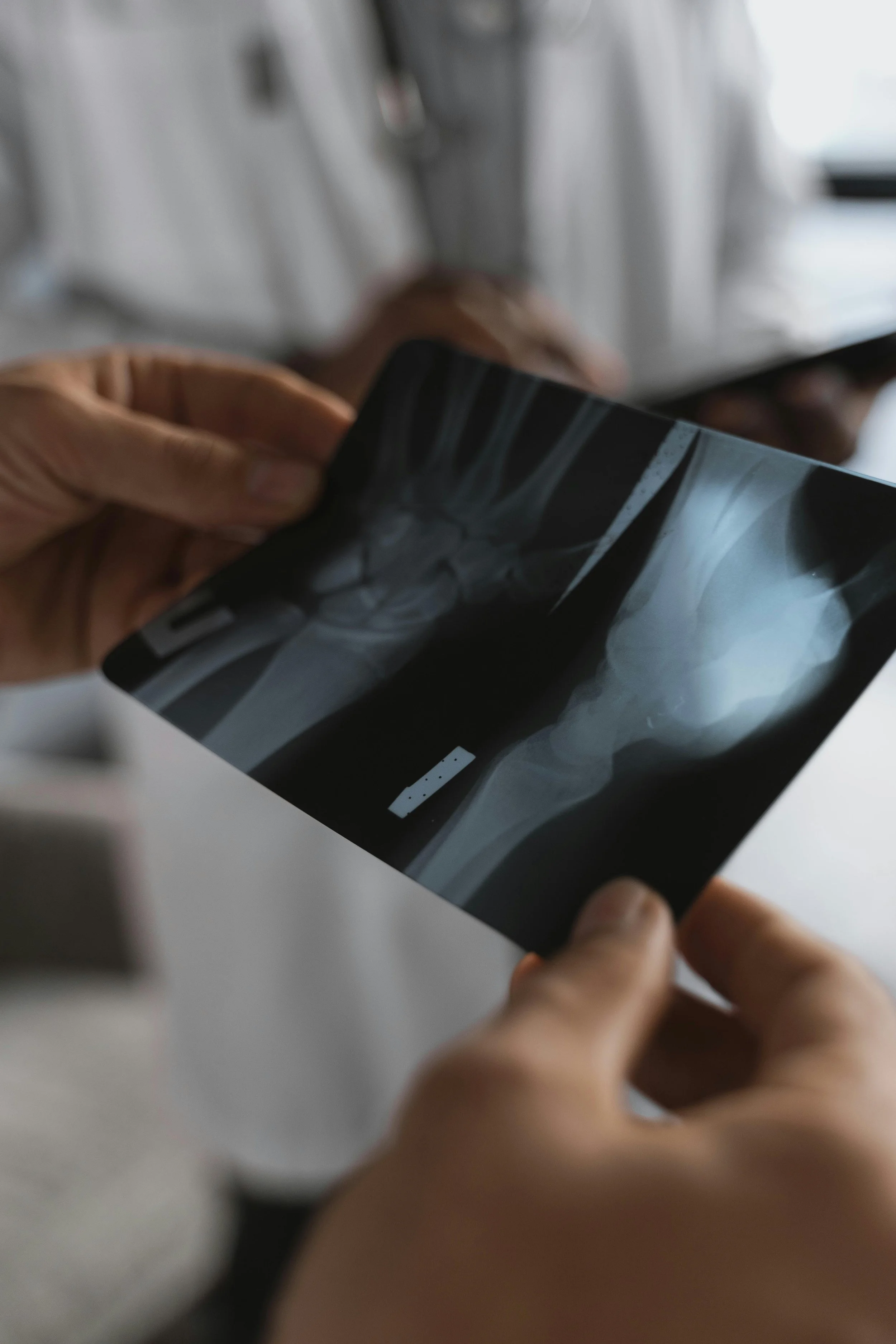 Fracture Clinic, Xray
