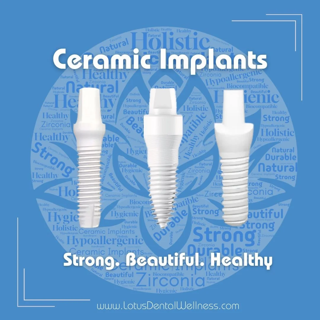 3 White ceramic dental implants, showing words Strong, Beautiful, Healthy.