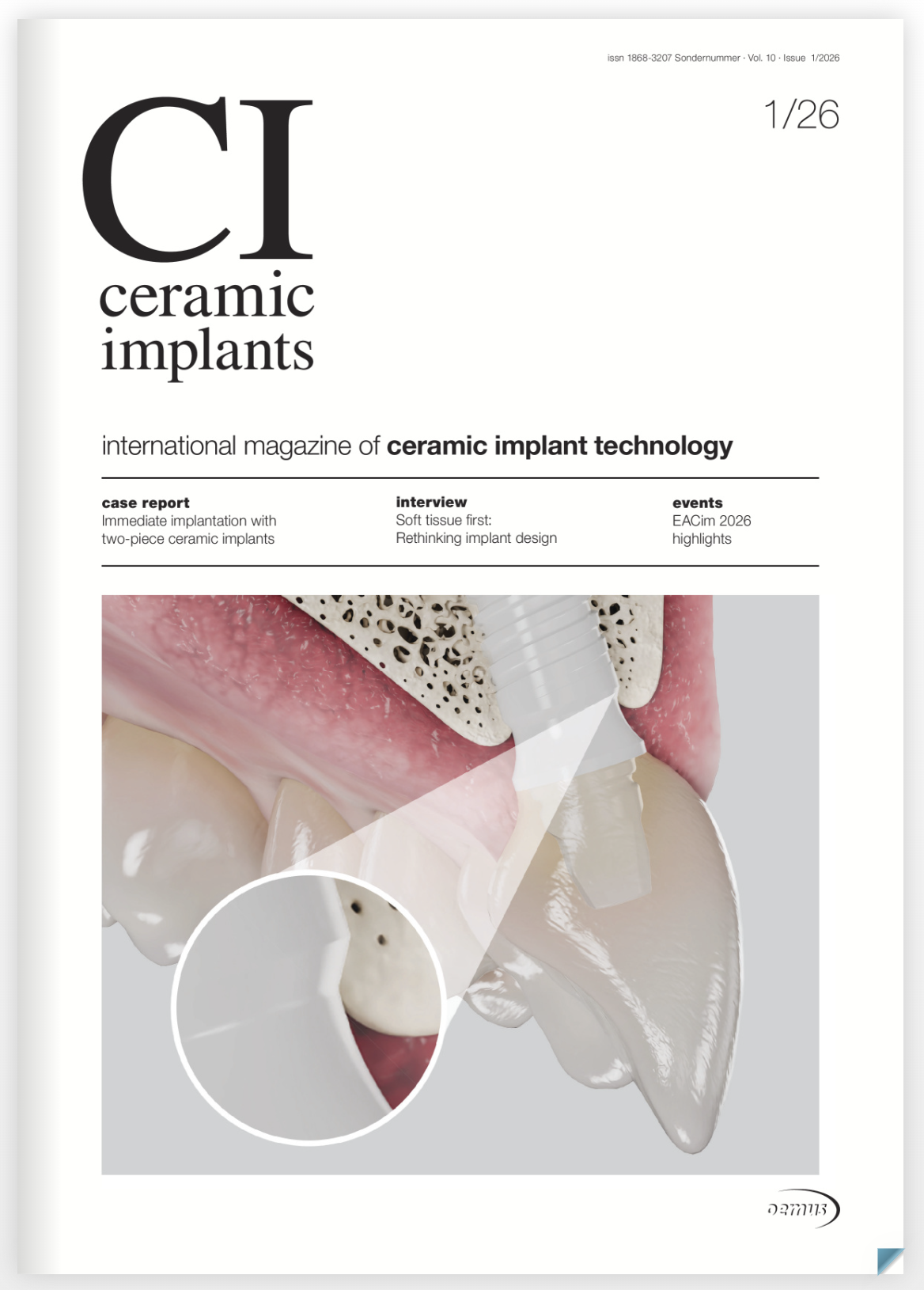 Ceramic Implants International Magazine Cover for 1/2026