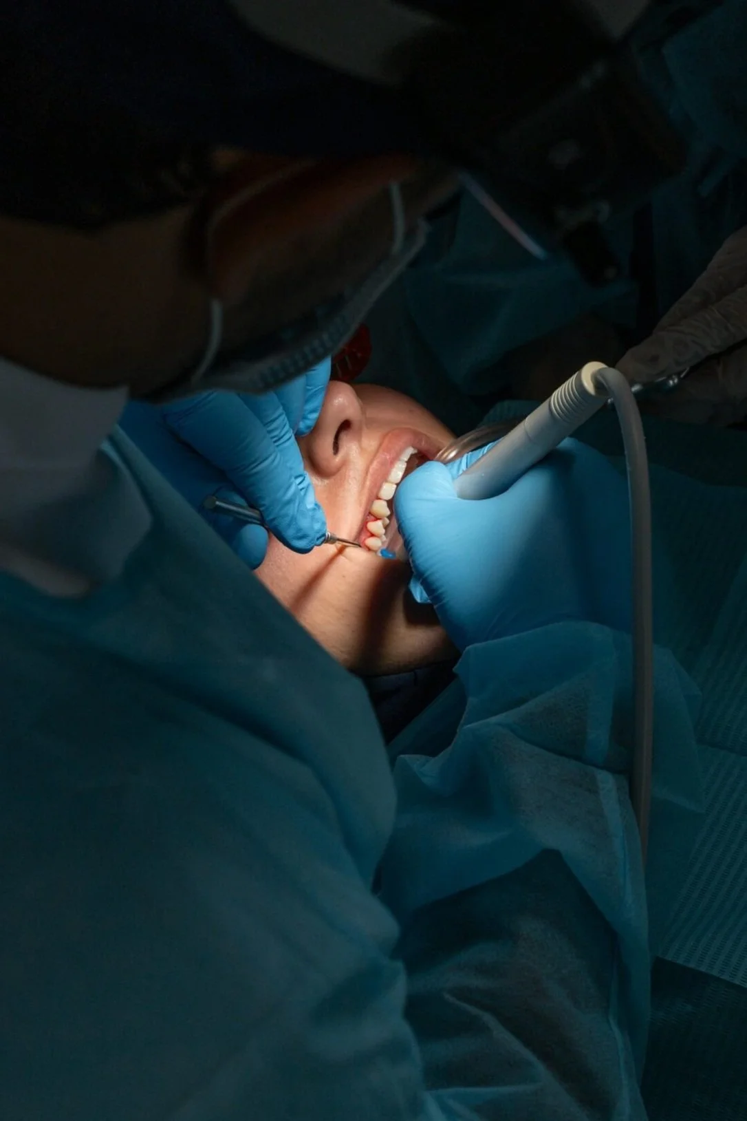 A person receiving dental treatment while lying in a dental chair, with a dentist using dental instruments in the patient's mouth.