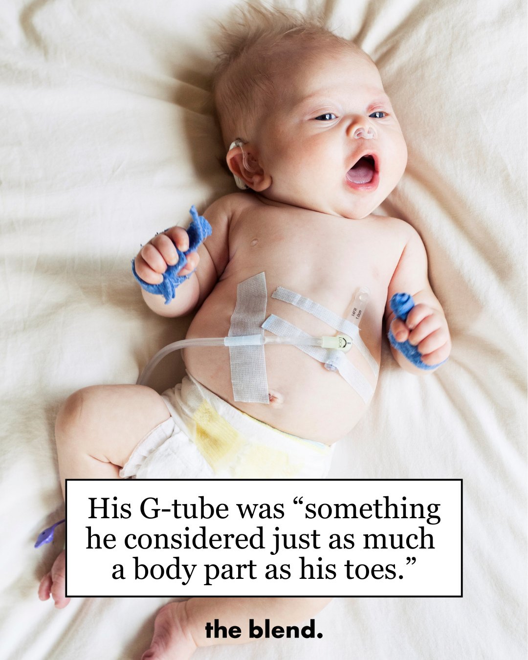 This sweet little guy was attached to his feeding tube in more ways than one. And his mum, Madeline Cheney of @the_rare_life, wrote a powerful personal essay on the parent experience of tube-feeding your newborn for @the_blend_mag. Link in bio.