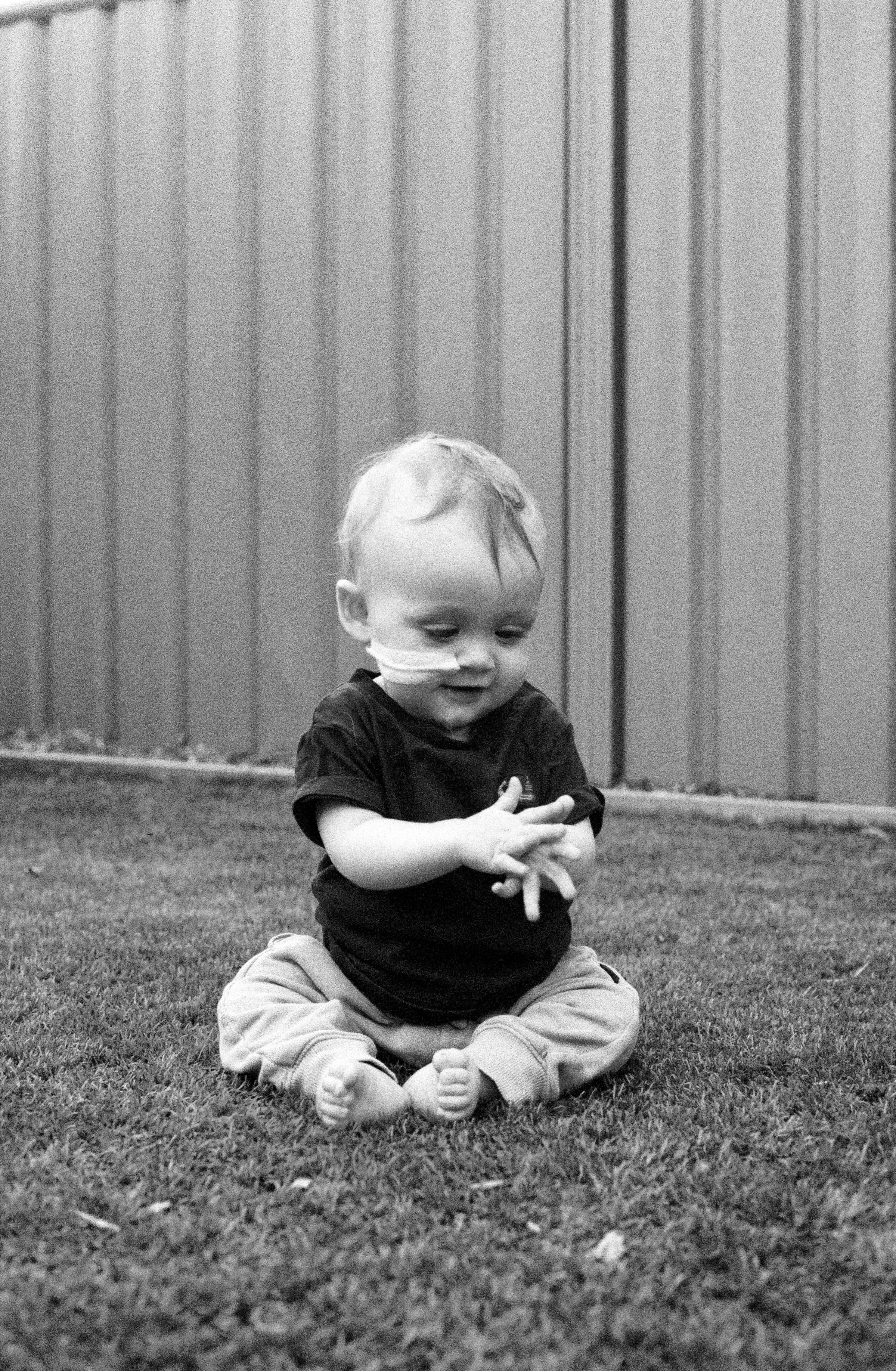 A young boy sits alone on the grass, absorbed in his own hands, an NG tube taped to his cheek. Quiet and content – just a kid in a backyard.