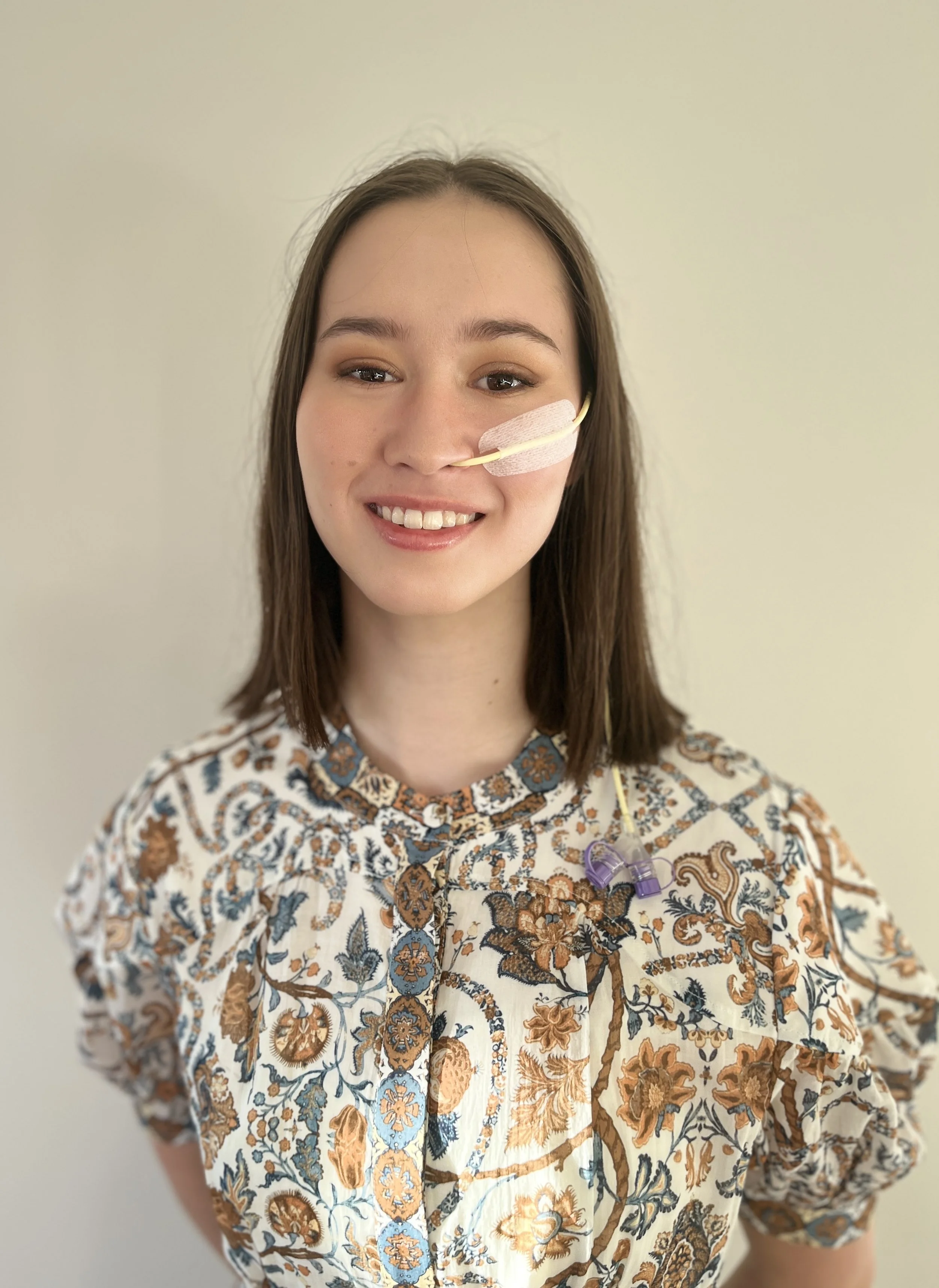 A young woman with shoulder-length brown hair smiles at the camera. She is wearing a floral patterned top and has a nasogastric tube taped to her cheek, with a feeding tube connector visible at her chest.