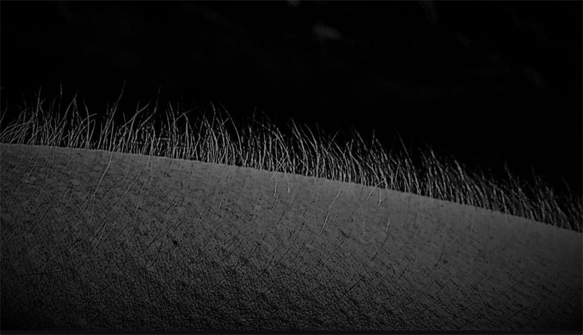 Black and white image showing a section of  human skin with goosebumps and hairs standing up straight.