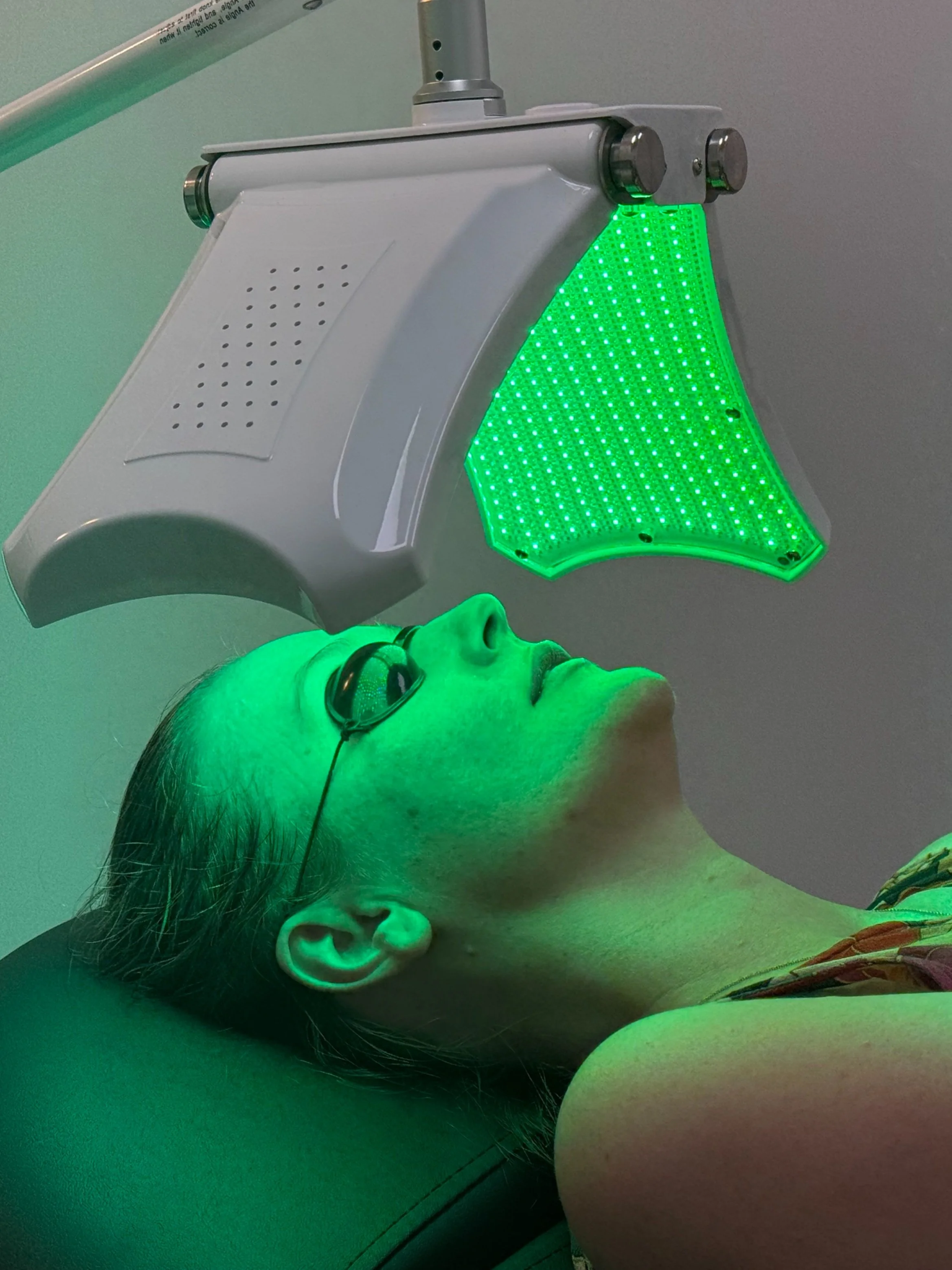 A person lying on a medical bed receiving a laser skin treatment, with a green laser device directed at their face and wearing protective glasses.
