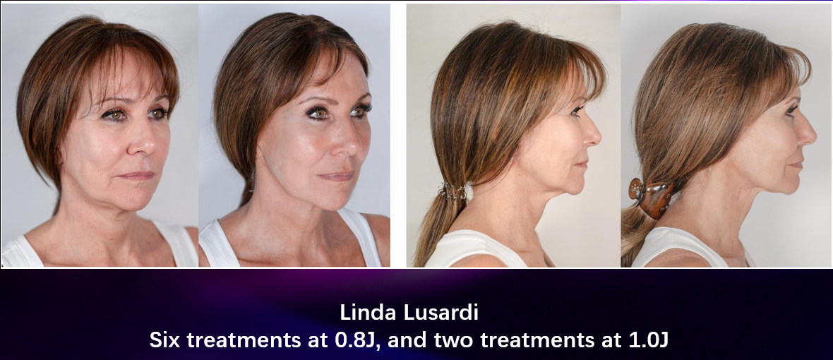 Mixed Energy Lifting - 6x Low & 2x High Energy.png