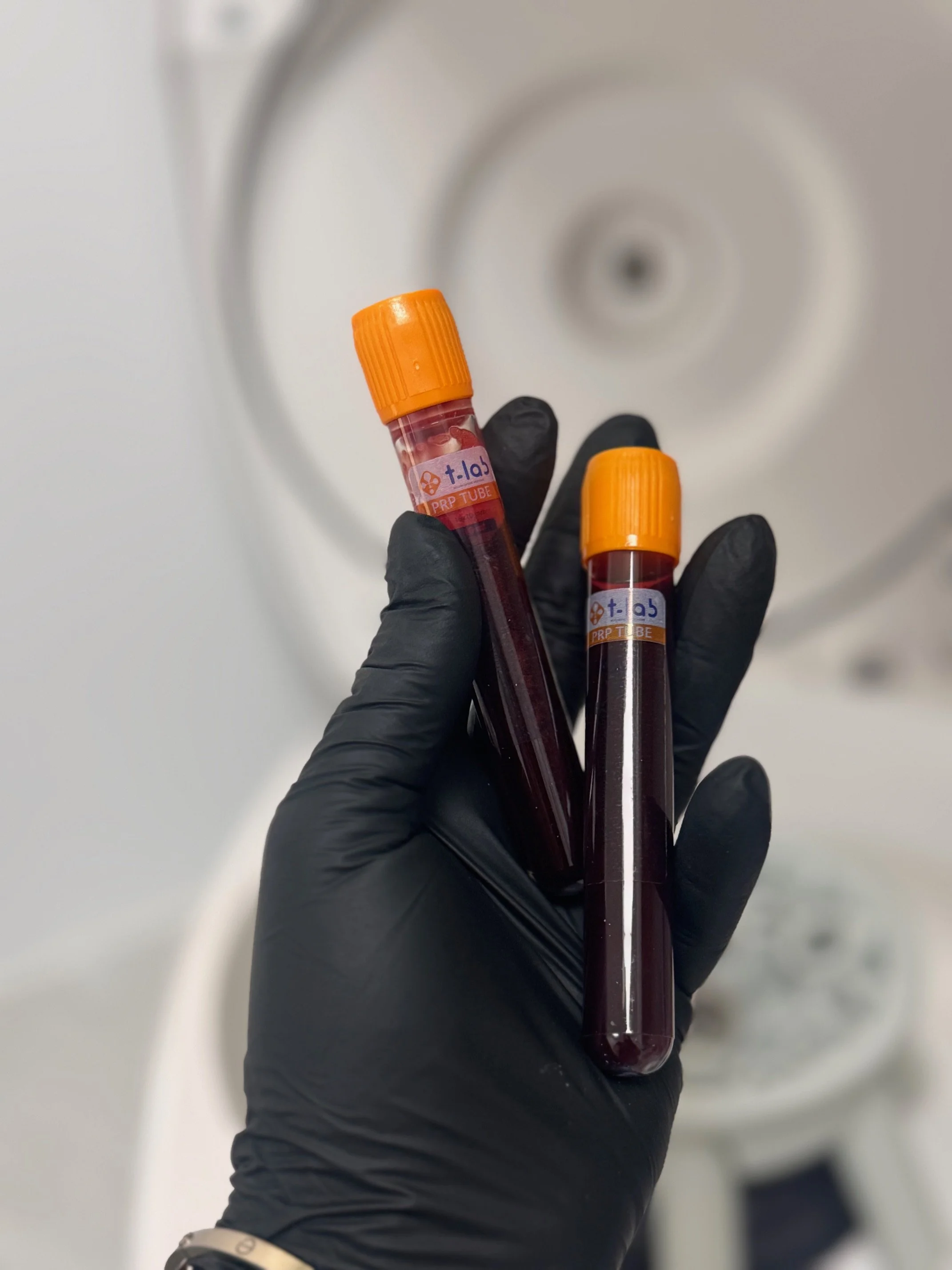 A hand wearing a black glove holding two blood sample tubes with orange caps, in a laboratory or medical setting.