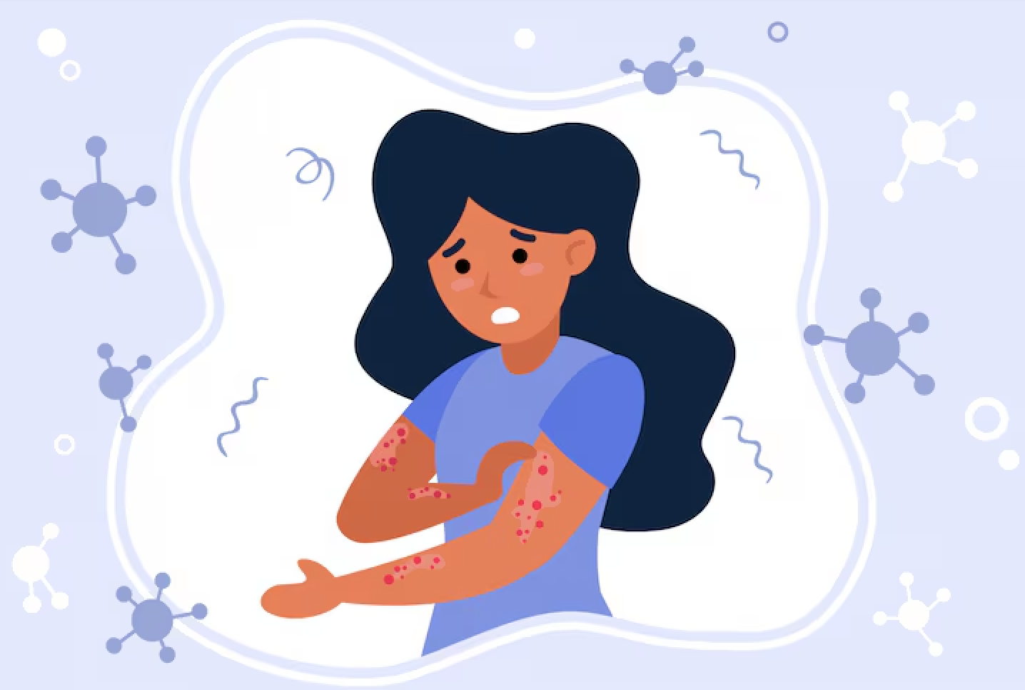 Scabies in Congregate Settings: Practical Guidance for Shelters and Public Health Staff