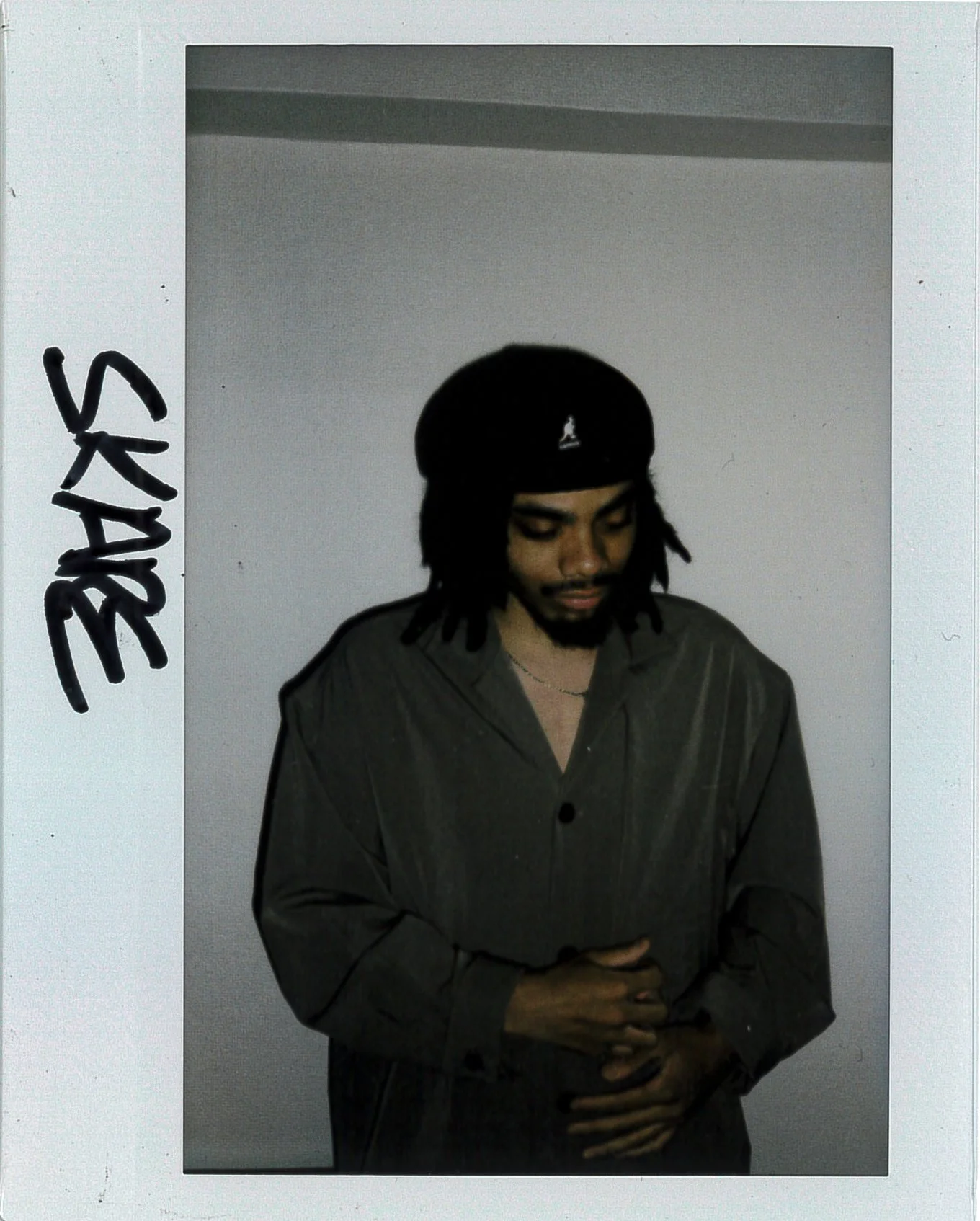 SKARE