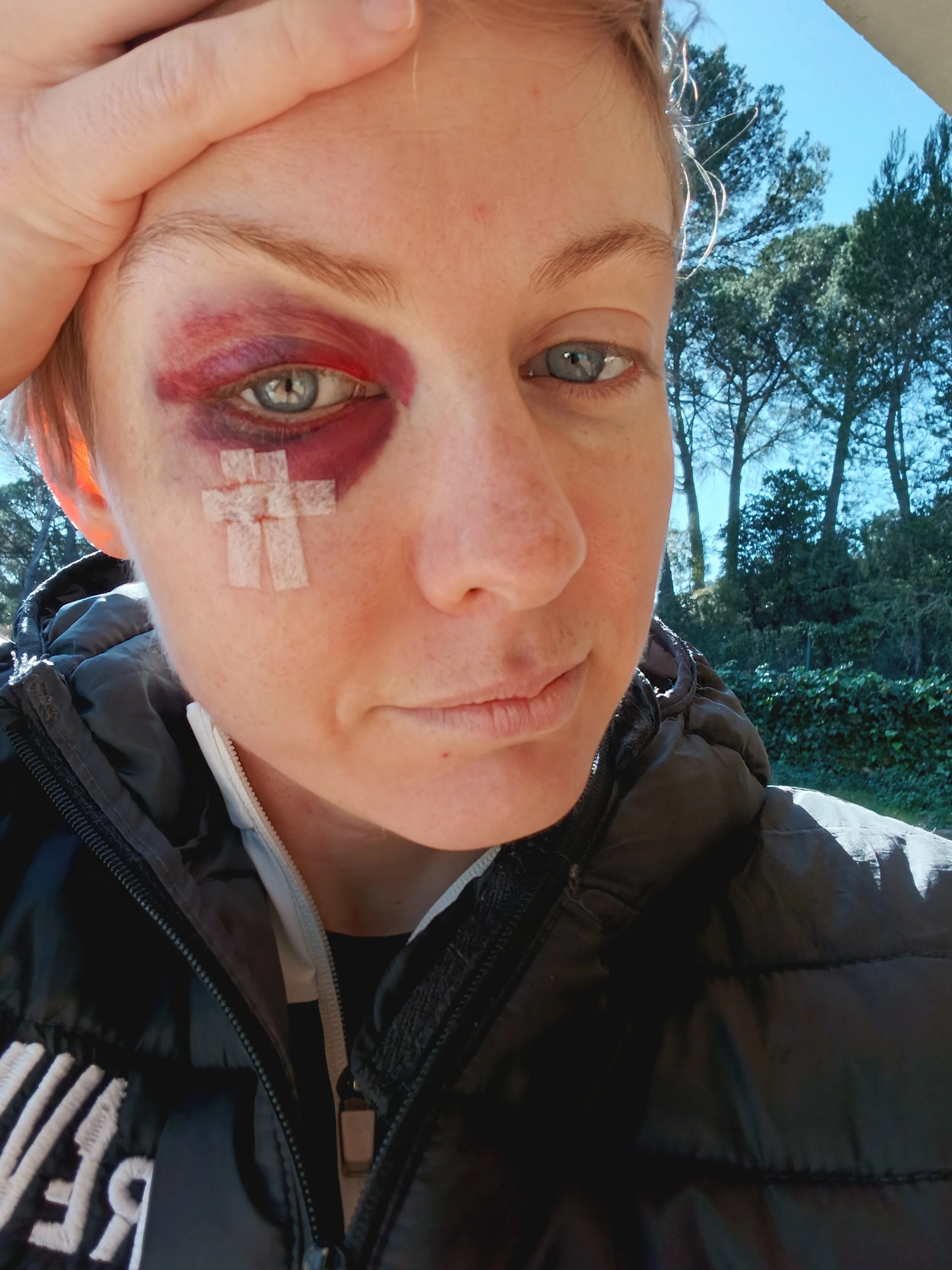 Concussion Recovery