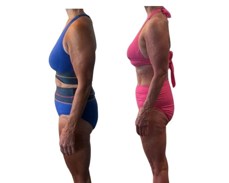 Side-by-side comparison of an elderly woman before and after weight loss, wearing different swimsuits.