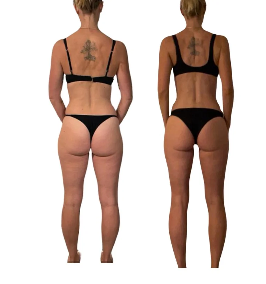 Side-by-side comparison of a woman showing before and after body transformation, with the woman wearing black underwear.