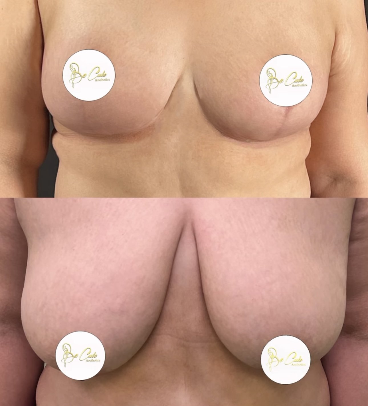 Reduction mammaire casablanca