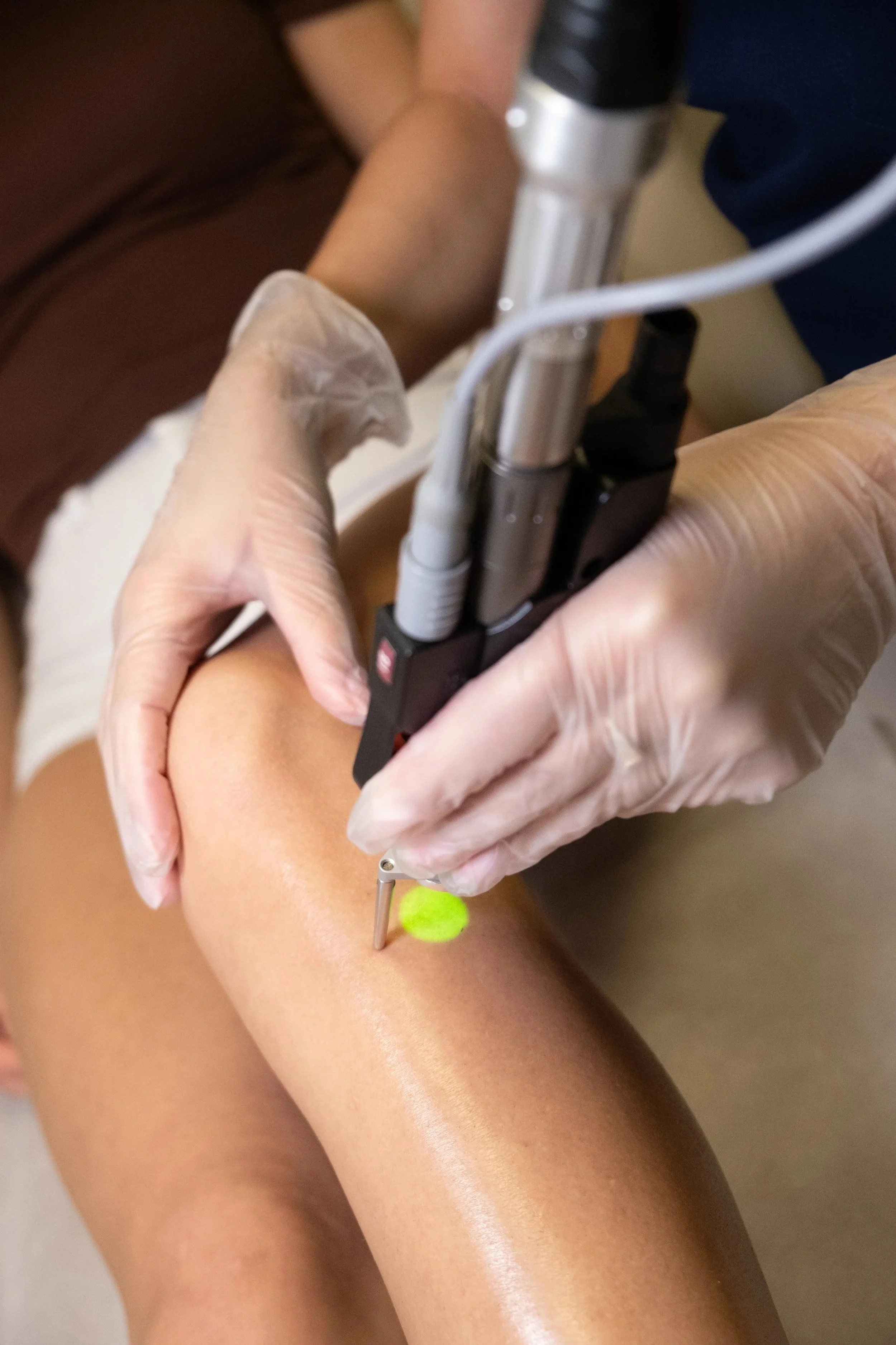 IS IDEAL IMAGE CLOSING?