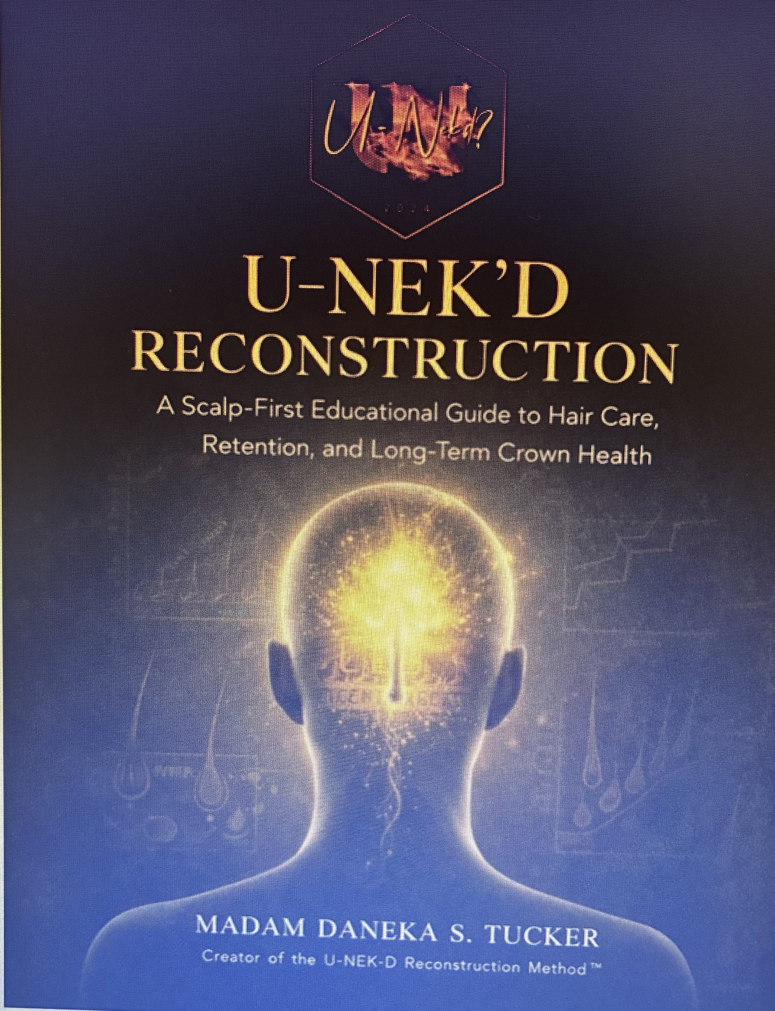 U-Nek'd Reconstruction: A Scalp-First Educational Guide