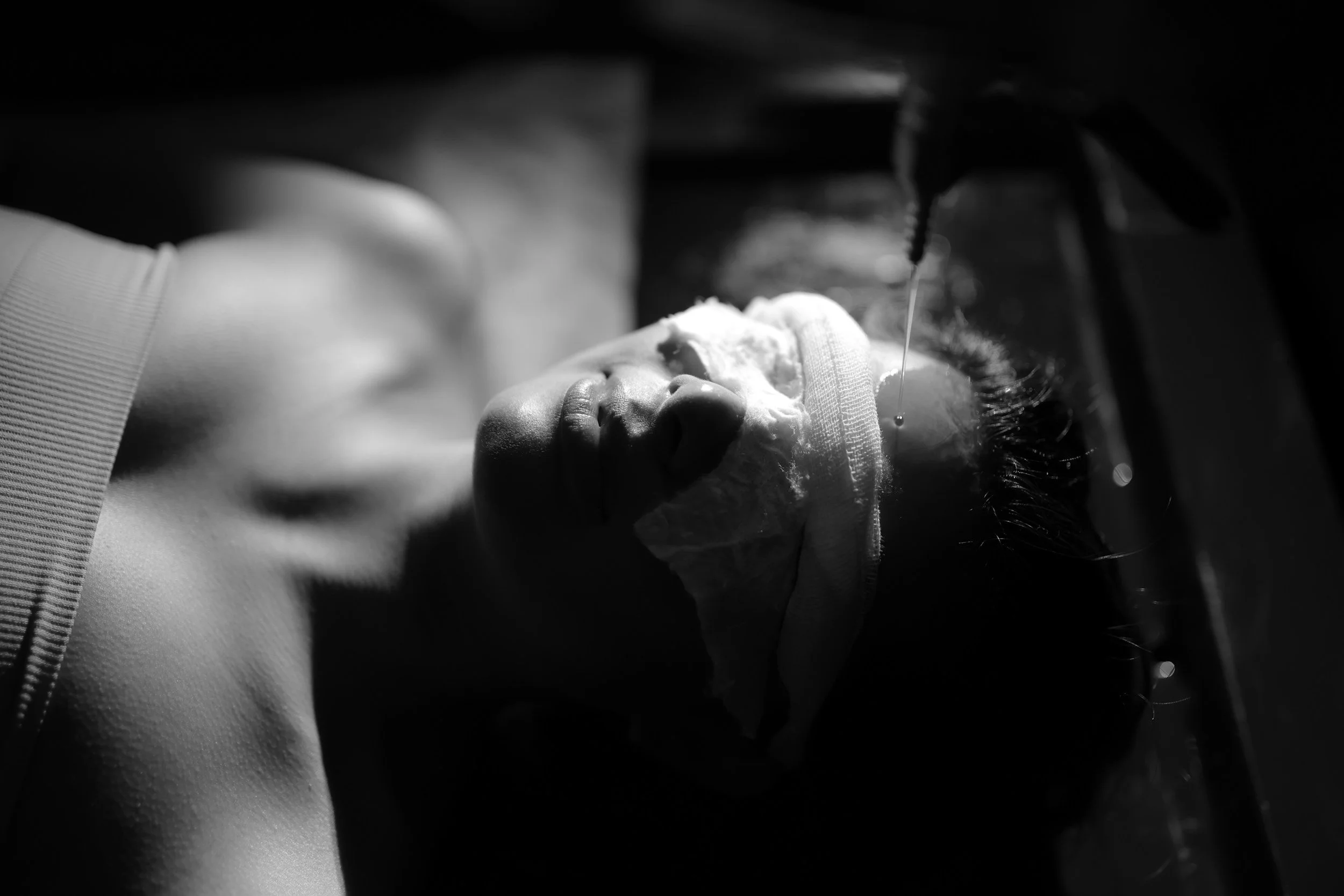 A person lying on a surgical table with a mask over their nose, receiving anesthesia from a machine, with a healthcare professional or anesthesiologist adjusting equipment.