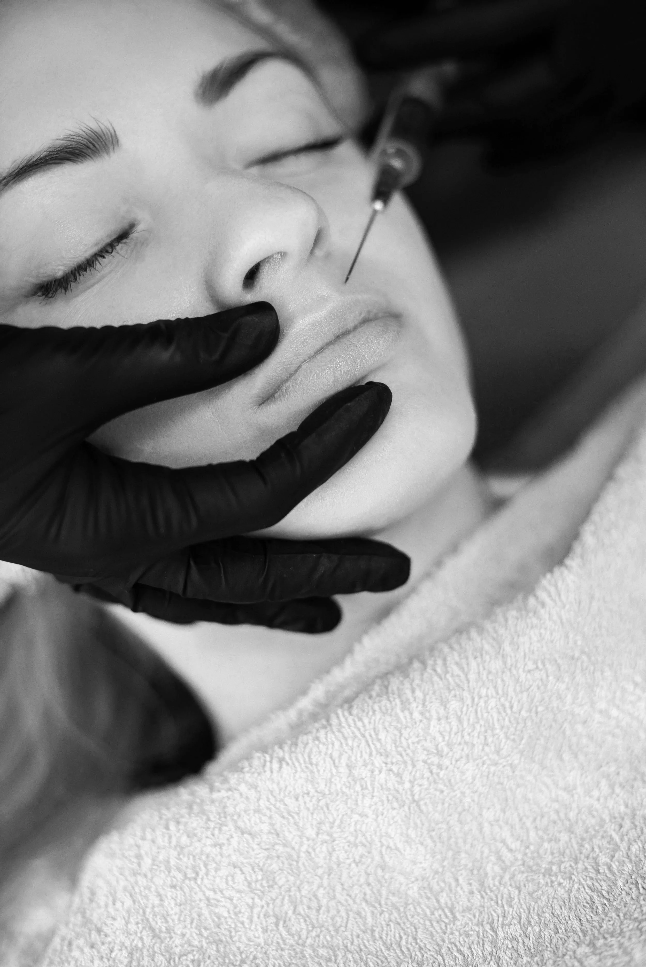 Dermal filler injections for facial volume restoration and contouring at Glow Med Spa