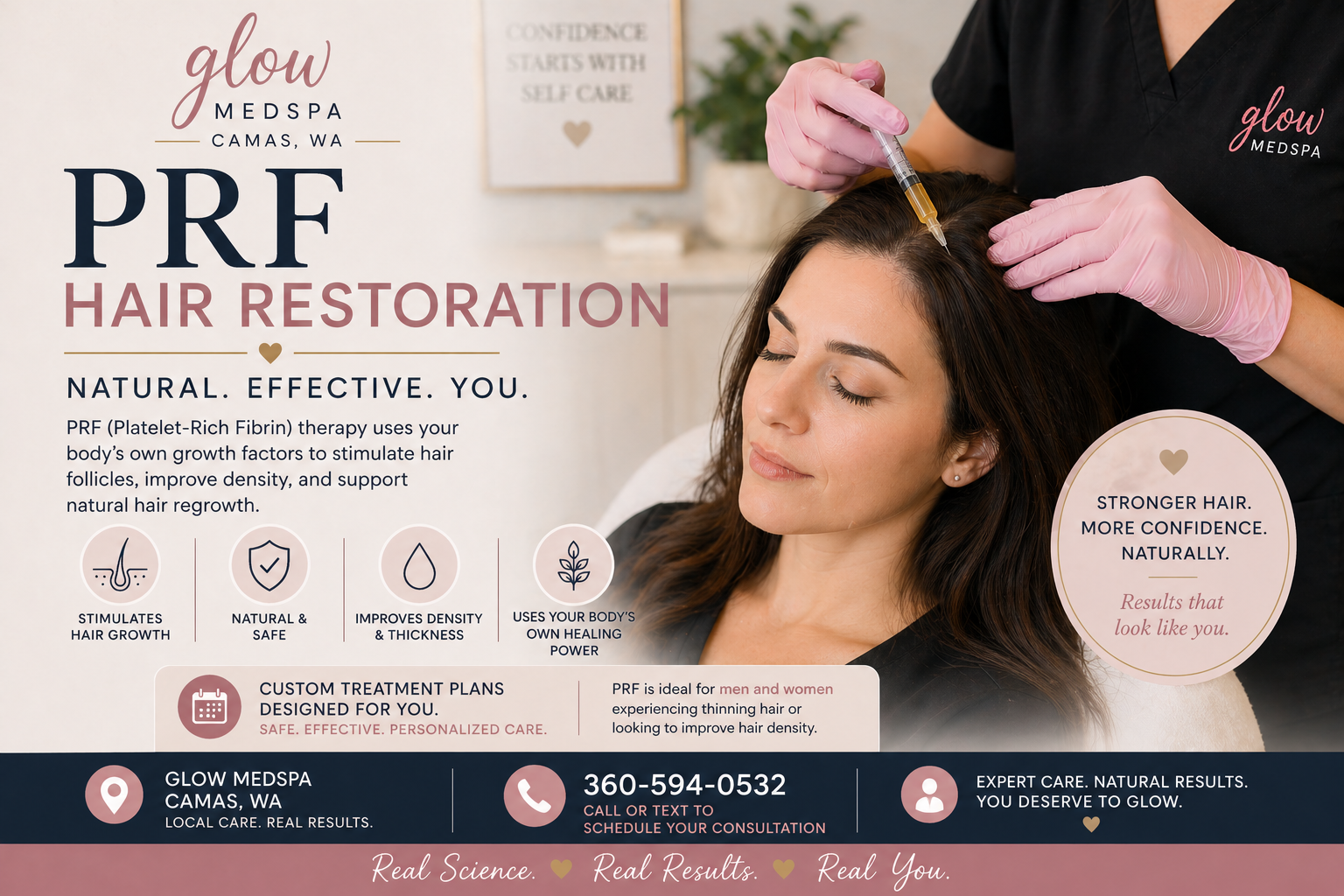 PRF Hair Restoration: A Natural Approach to Thinning Hair.