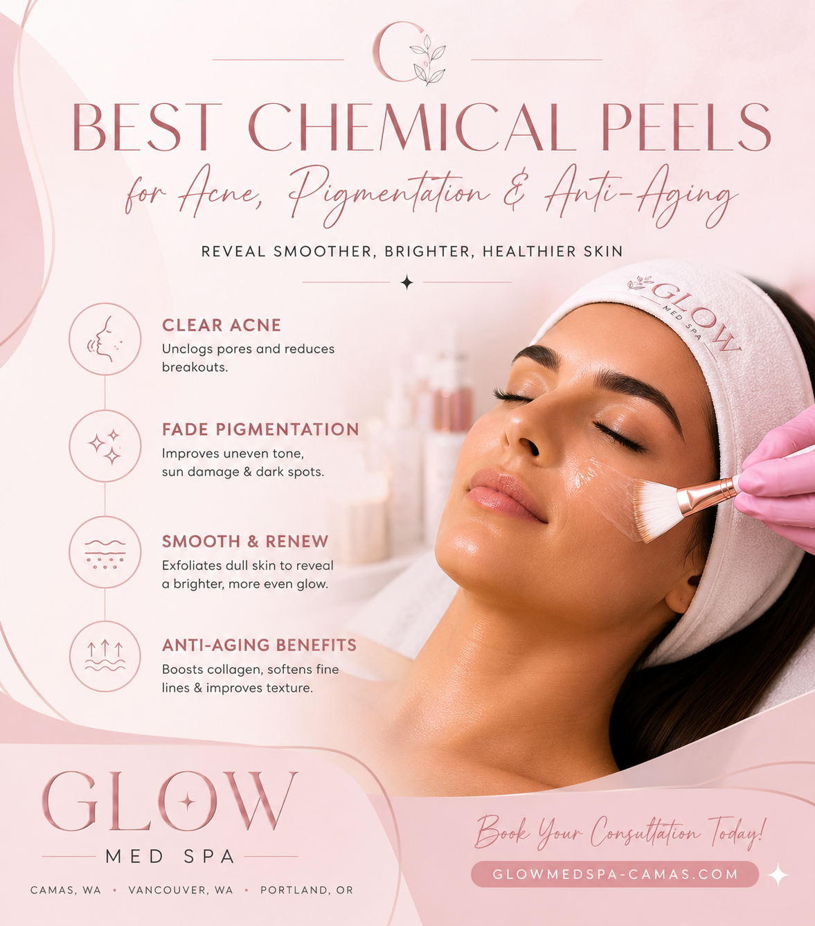 Best Chemical Peels in Camas WA for Acne, Pigmentation, and Anti-Aging
