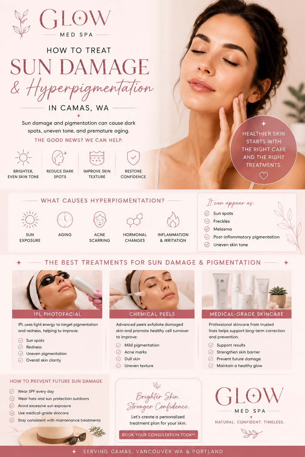 How to Treat Sun Damage and Hyperpigmentation in Camas WA