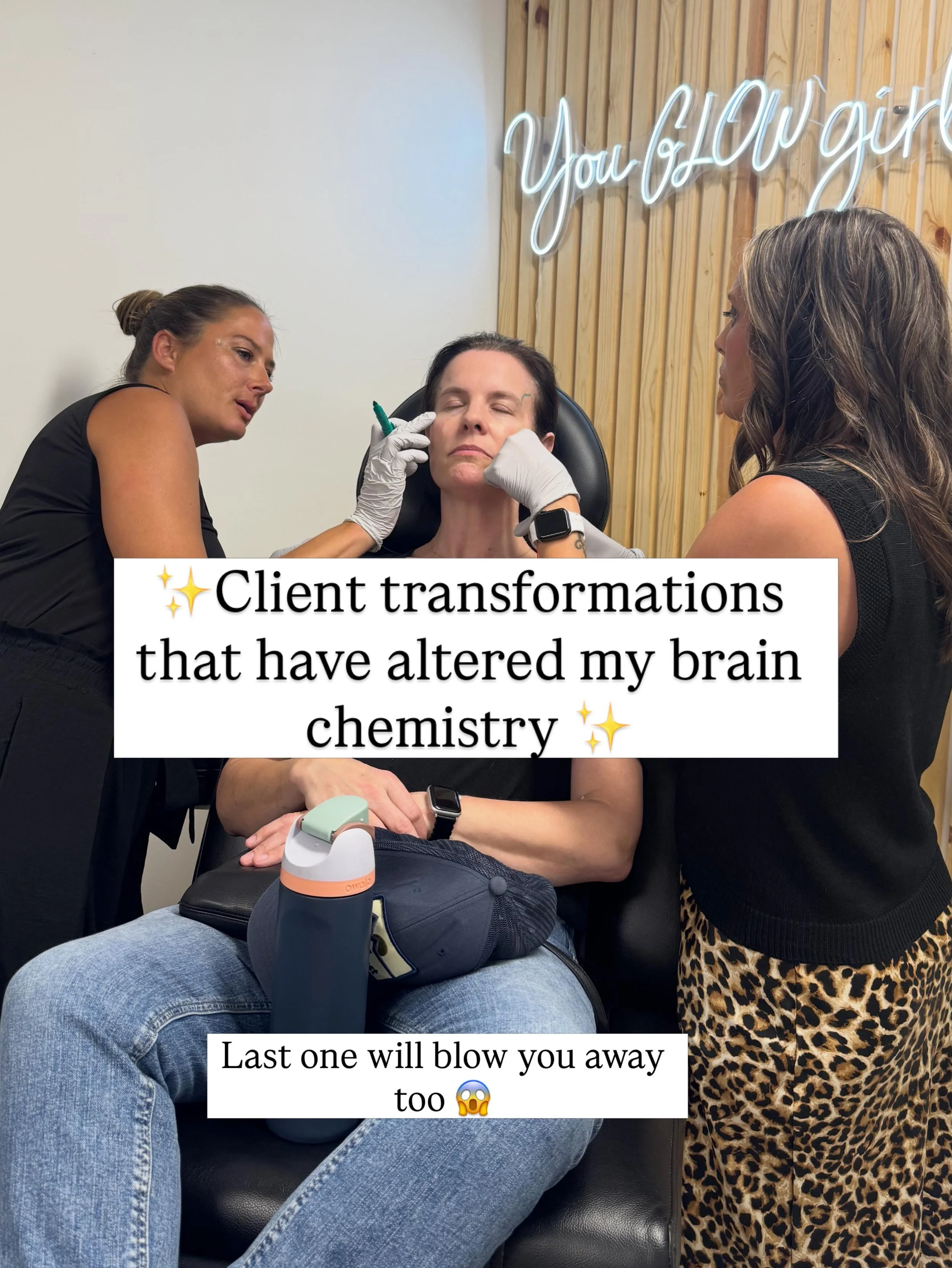 Our clients transformations really speak for themselves! We can&rsquo;t even believe our eyes when we see these amazing results! Which one is your favorite? 🤩 #before&amp;after #botoxfiller #vancouvermedspa