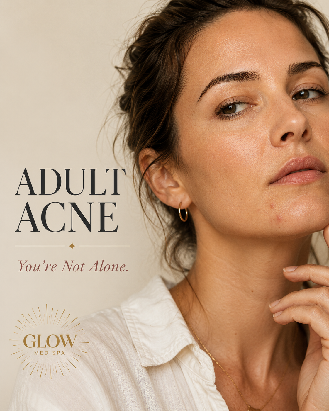 Why Adult Acne Happens and the Best Treatments for Clearer Skin.