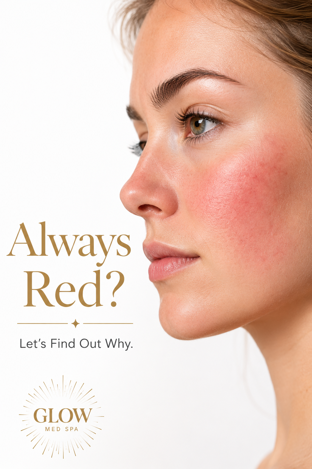 Rosacea vs Sensitive Skin: How to Tell the Difference