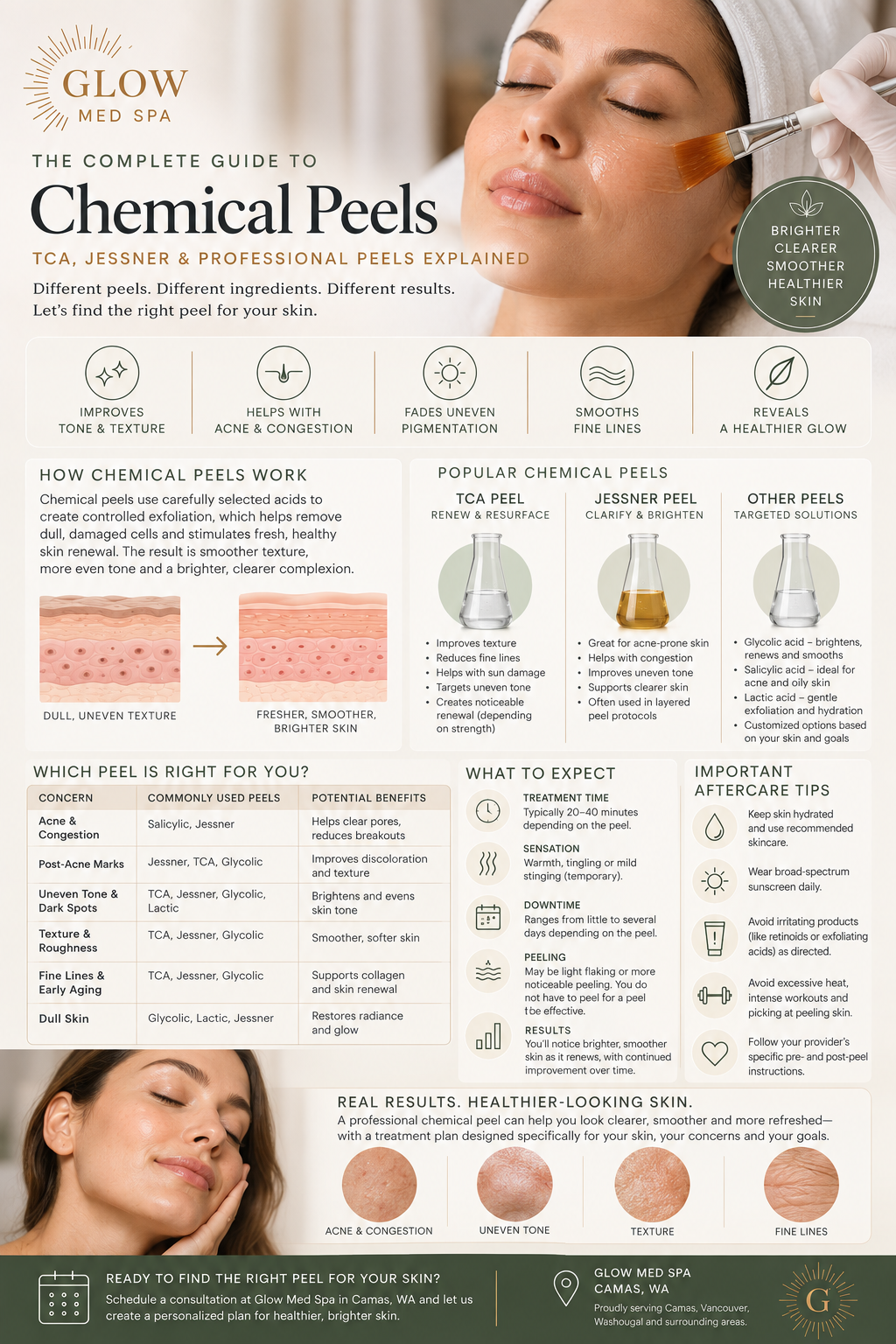Which Chemical Peel Is Right for You?