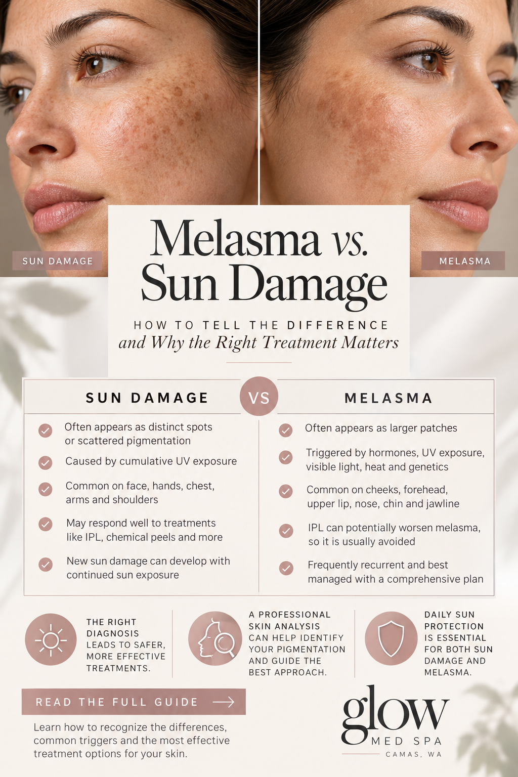 Melasma vs. Sun Damage: How to Tell the Difference