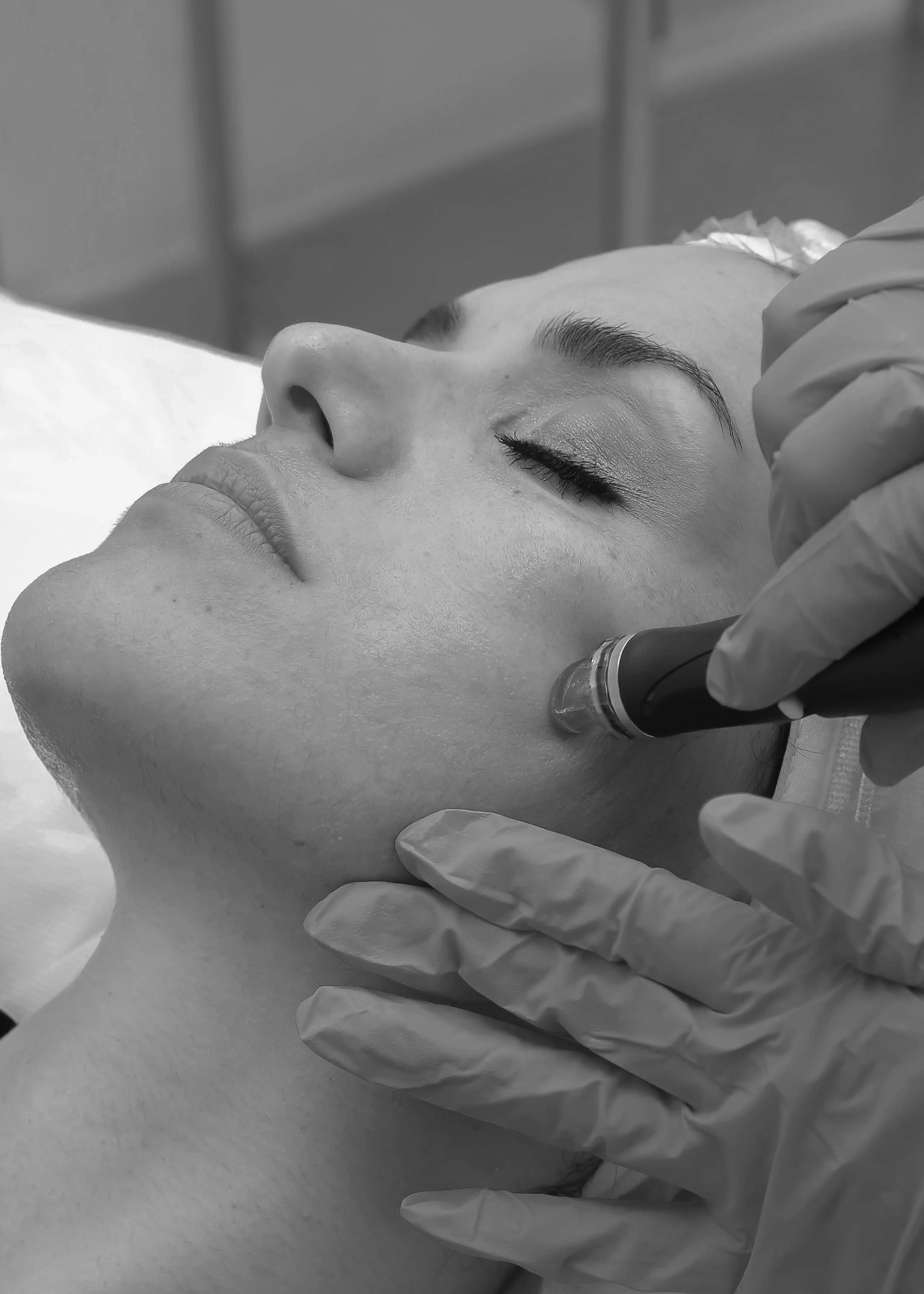 Platelet-Rich Fibrin microneedling for collagen stimulation and skin rejuvenation