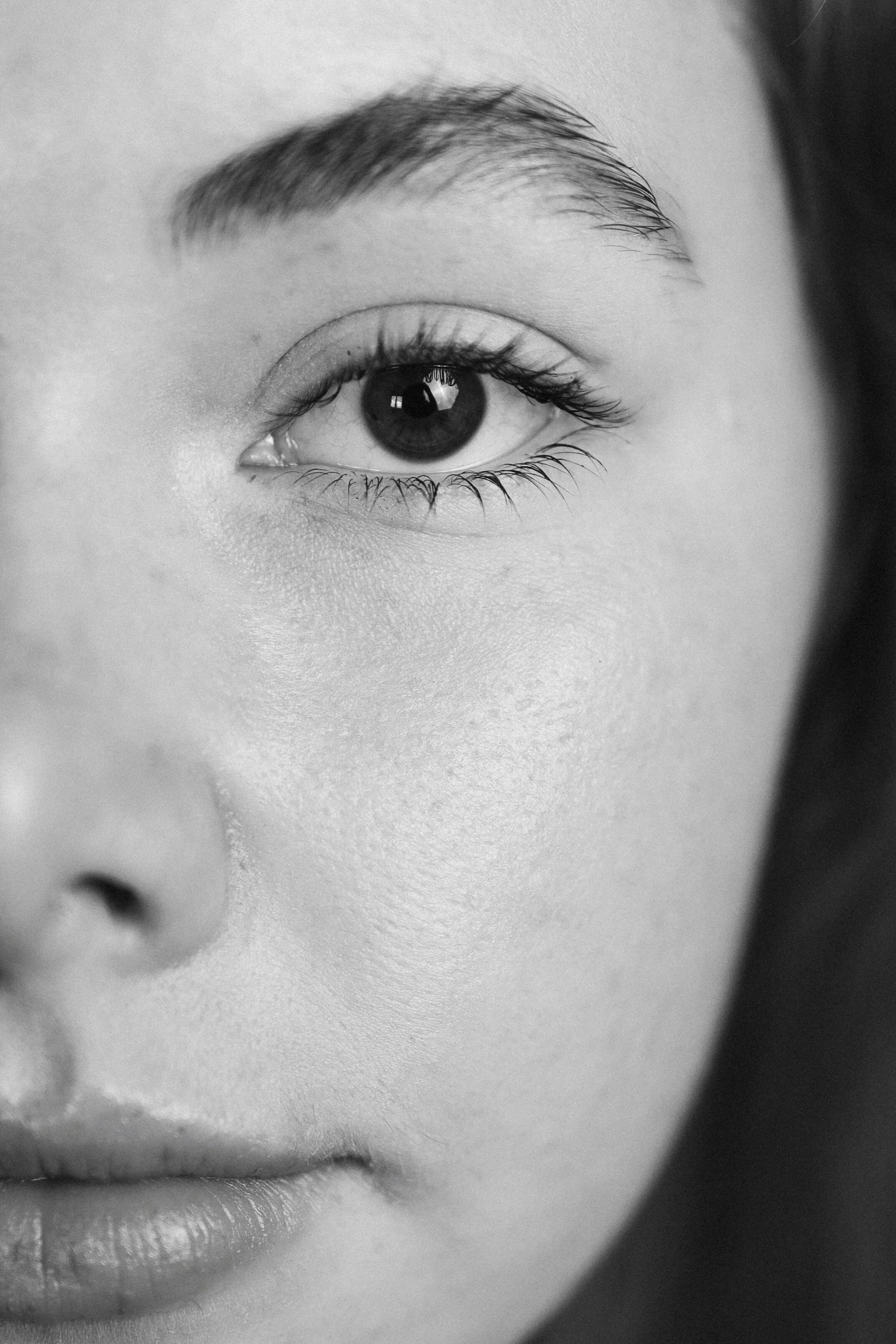 chemical peel for smoother, brighter, more even-toned skin at Glow Med Spa