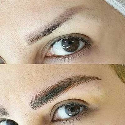 Close-up of a person's eyes and eyebrows showing a before and after correction of an old eyebrows tattoo.