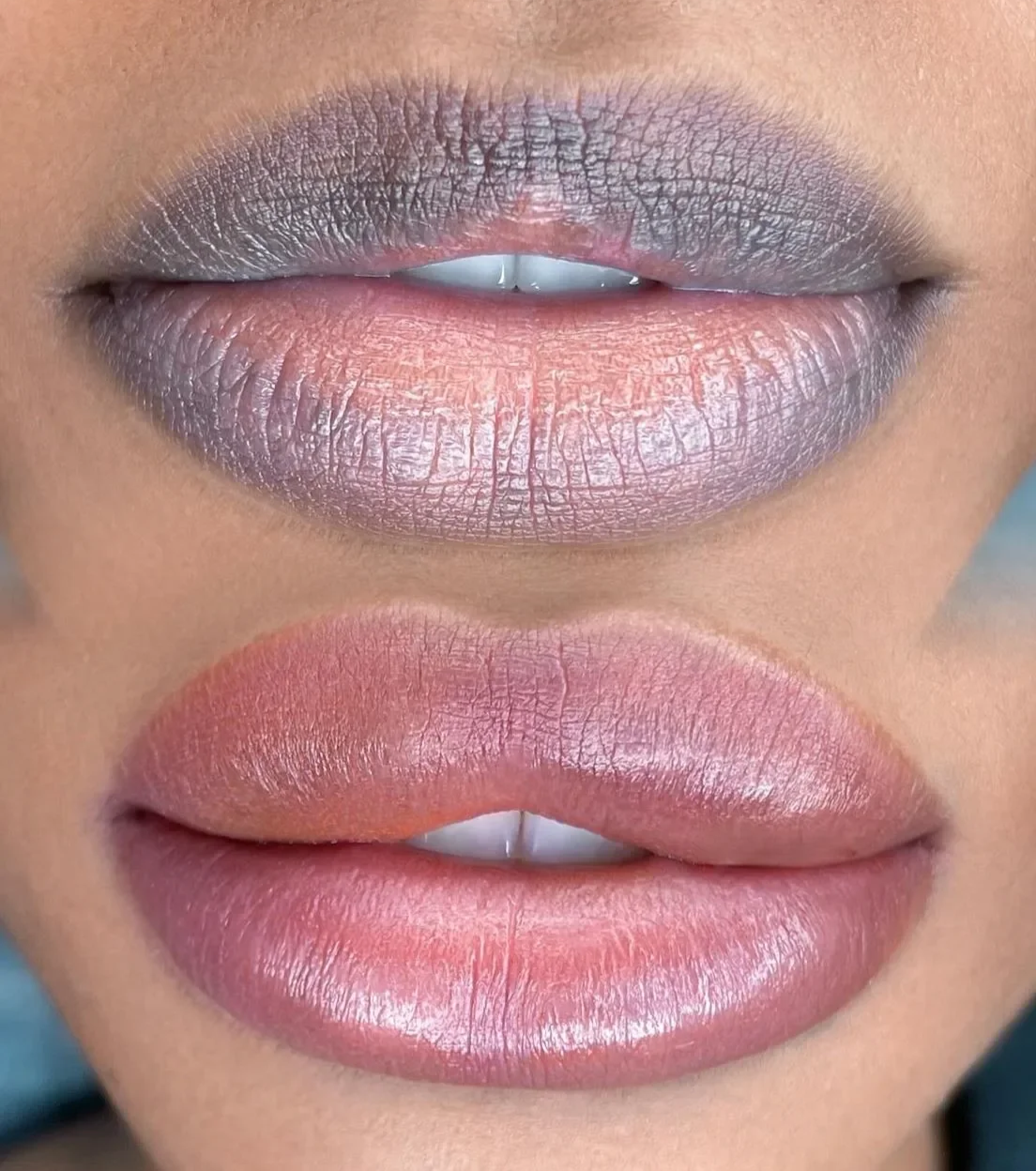 Close-up of a person's lips with before- and after- lip neutralization.